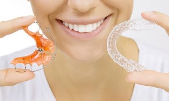 nieng rang mat trong invisalin