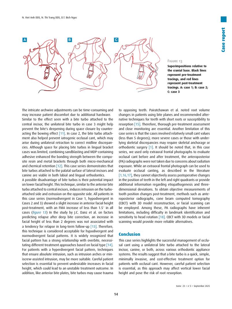Hình 3. Trang tiêu biểu (trang 14 của PDF) được trích từ bài báo gốc để người đọc đối chiếu.