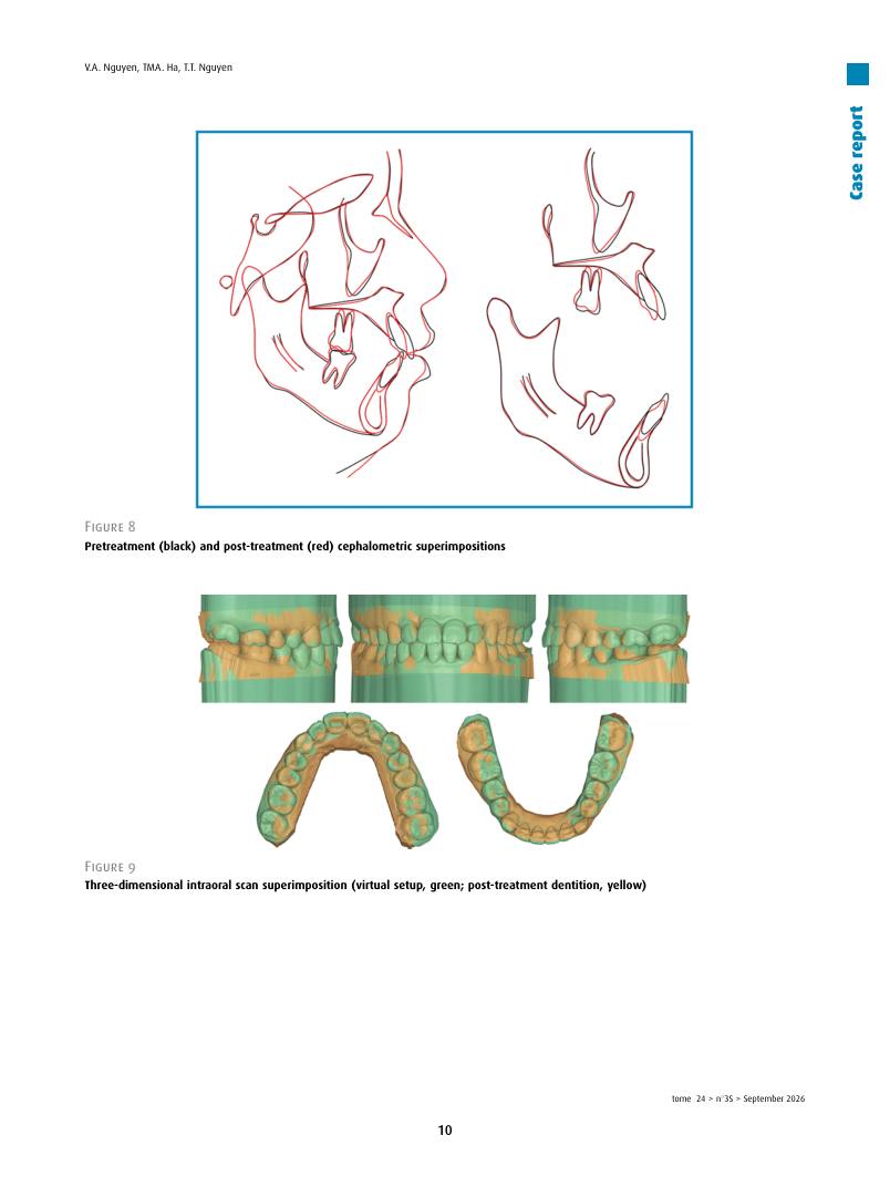 Hình 3. Trang tiêu biểu (trang 10 của PDF) được trích từ bài báo gốc để người đọc đối chiếu.