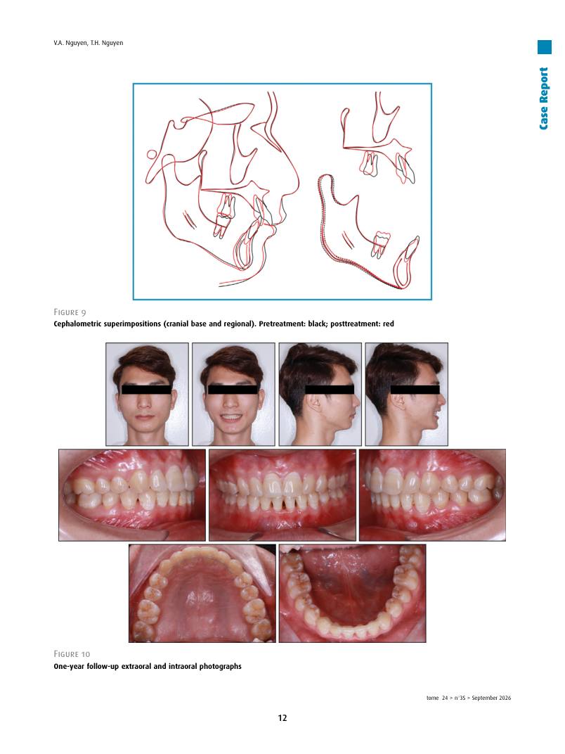 Hình 3. Trang tiêu biểu (trang 12 của PDF) được trích từ bài báo gốc để người đọc đối chiếu.