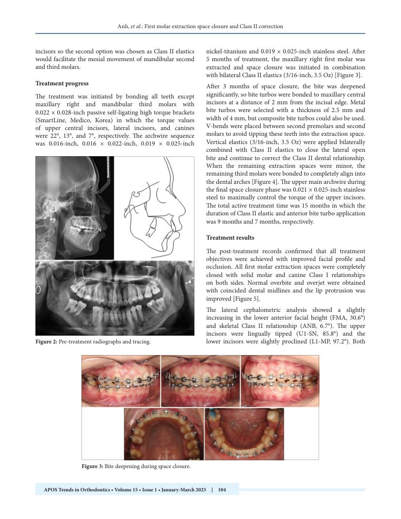 Hình 3. Trang tiêu biểu (trang 3 của PDF) được trích từ bài báo gốc để người đọc đối chiếu.