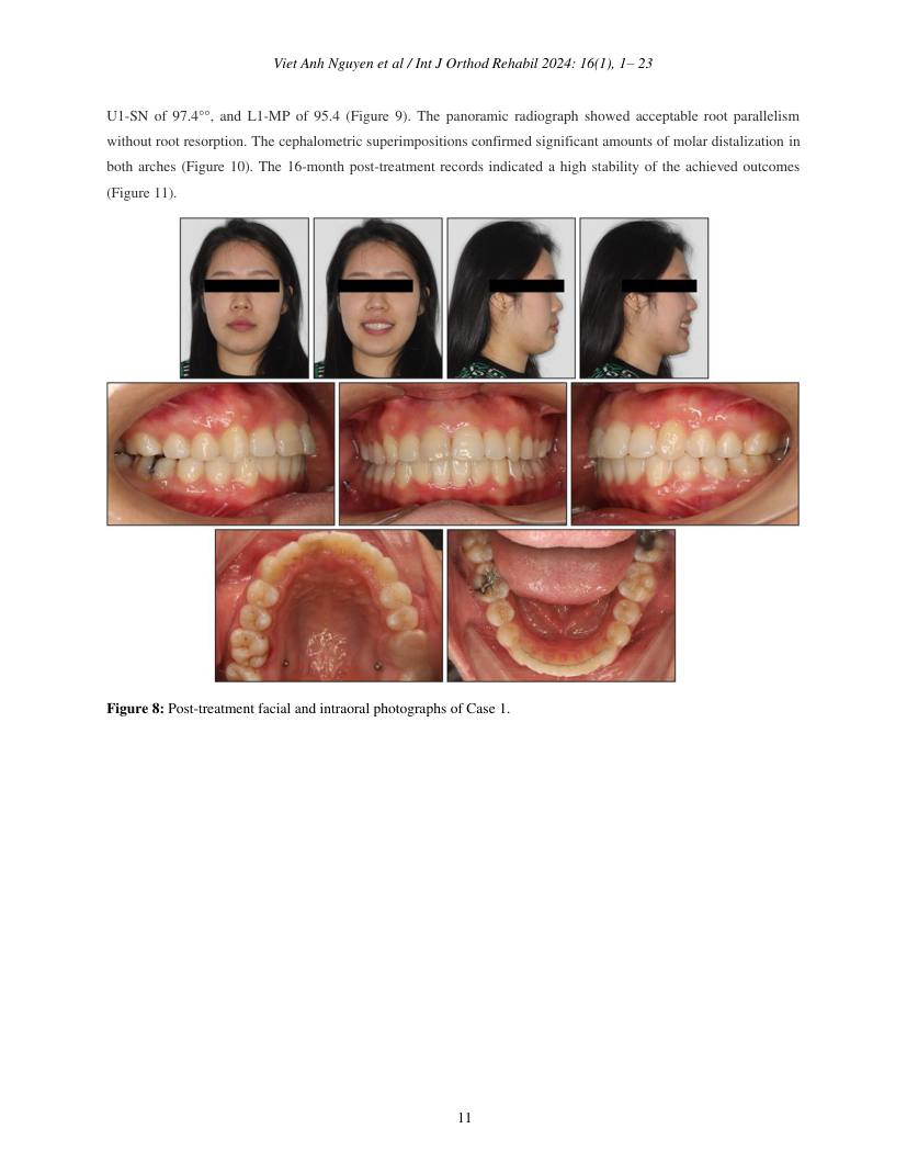 Hình 2. Trang tiêu biểu (trang 11 của PDF) được trích từ bài báo gốc để người đọc đối chiếu.