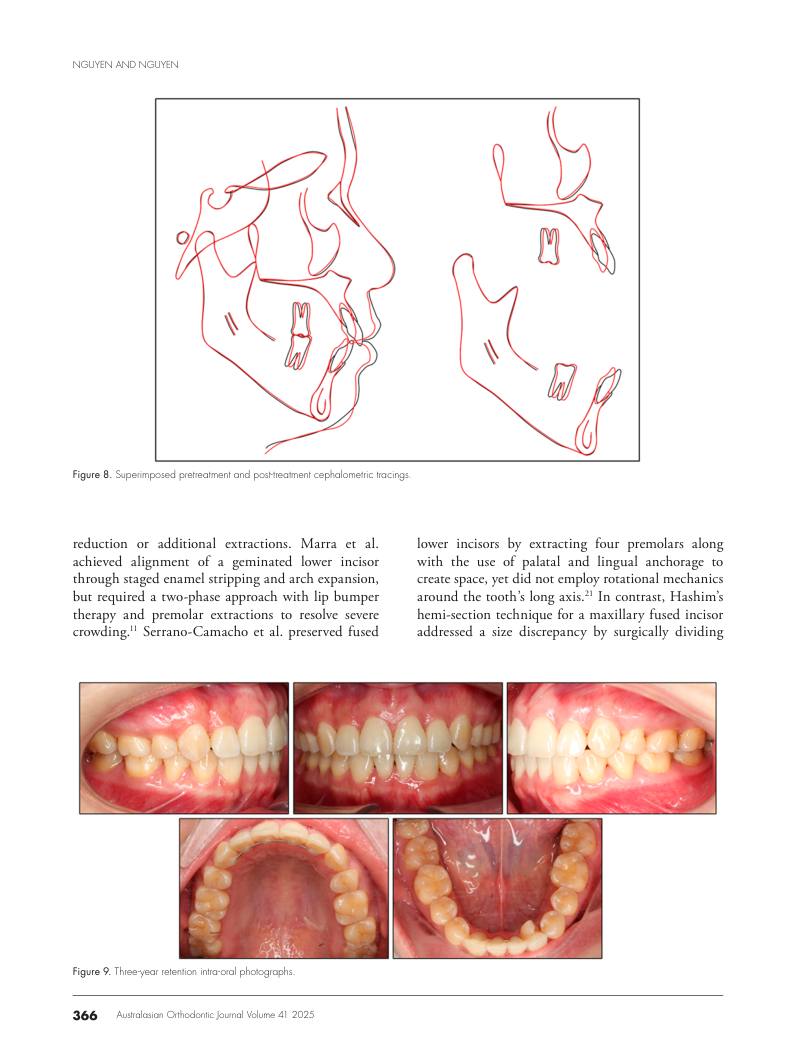 Hình 3. Trang tiêu biểu (trang 10 của PDF) được trích từ bài báo gốc để người đọc đối chiếu.