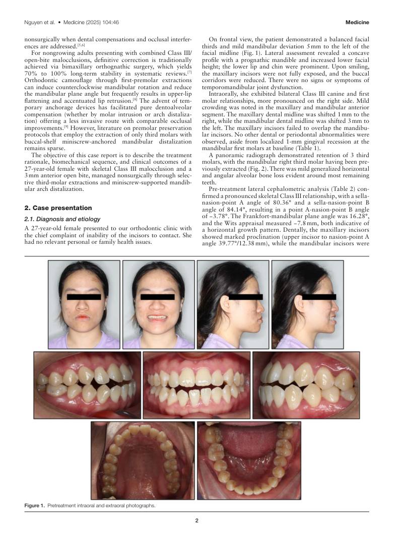 Hình 2. Trang tiêu biểu (trang 2 của PDF) được trích từ bài báo gốc để người đọc đối chiếu.