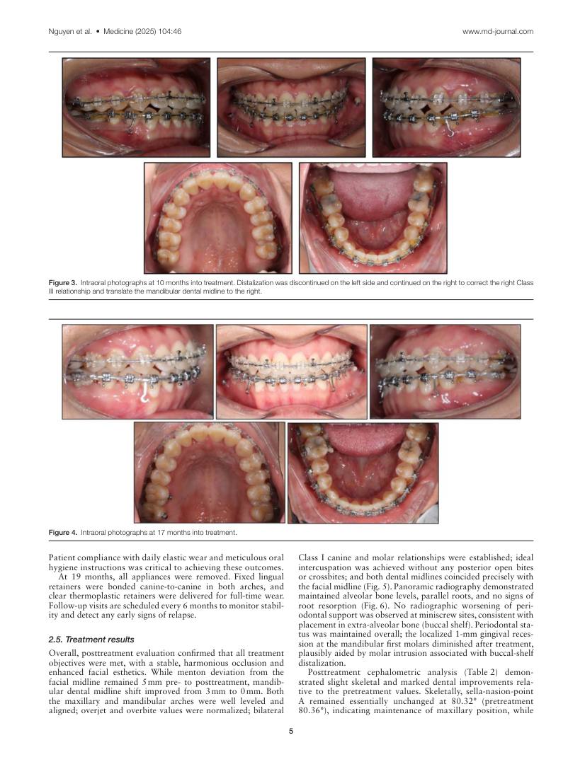 Hình 3. Trang tiêu biểu (trang 5 của PDF) được trích từ bài báo gốc để người đọc đối chiếu.