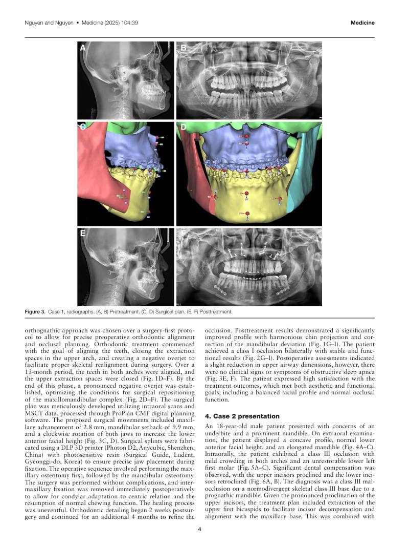 Hình 2. Trang tiêu biểu (trang 4 của PDF) được trích từ bài báo gốc để người đọc đối chiếu.