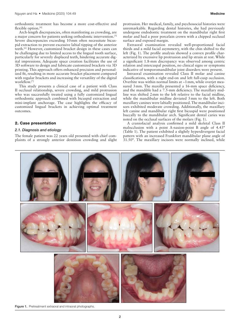 Hình 2. Trang tiêu biểu (trang 2 của PDF) được trích từ bài báo gốc để người đọc đối chiếu.