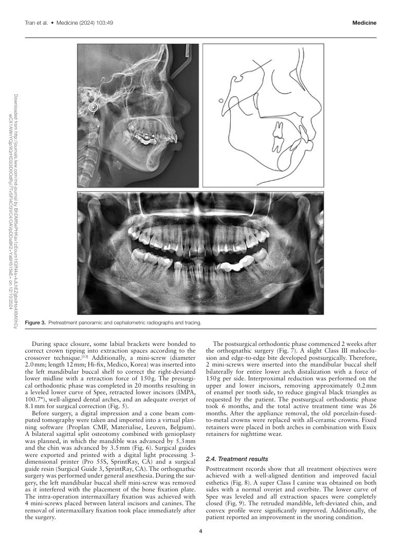 Hình 2. Trang tiêu biểu (trang 4 của PDF) được trích từ bài báo gốc để người đọc đối chiếu.