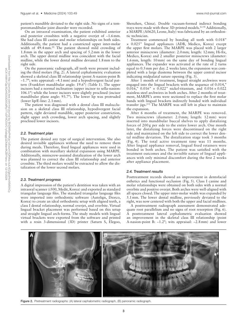 Hình 2. Trang tiêu biểu (trang 3 của PDF) được trích từ bài báo gốc để người đọc đối chiếu.
