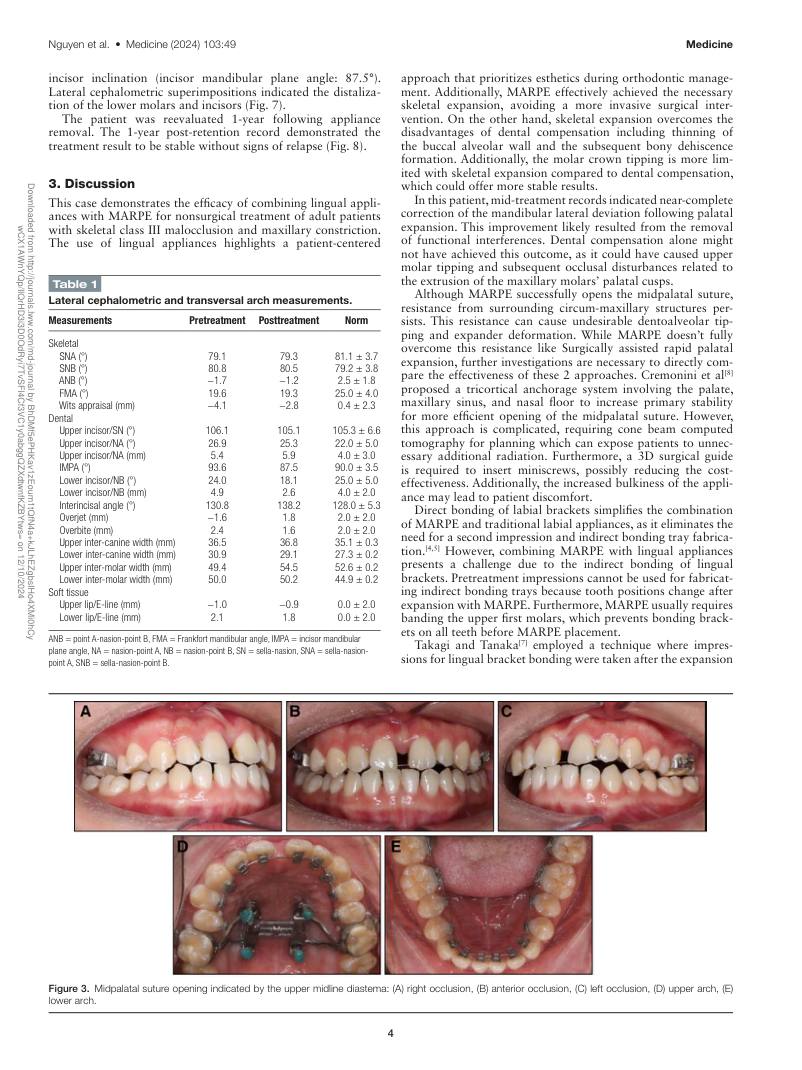 Hình 3. Trang tiêu biểu (trang 4 của PDF) được trích từ bài báo gốc để người đọc đối chiếu.