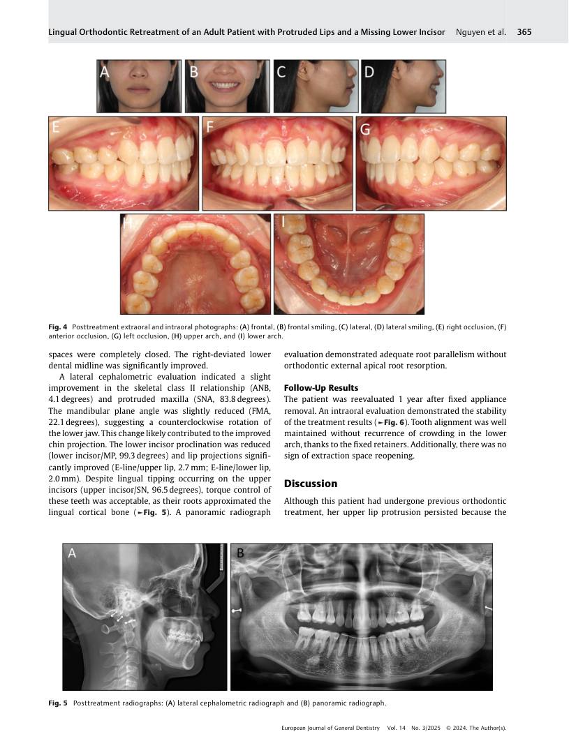 Hình 3. Trang tiêu biểu (trang 5 của PDF) được trích từ bài báo gốc để người đọc đối chiếu.